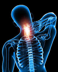 Neckpain