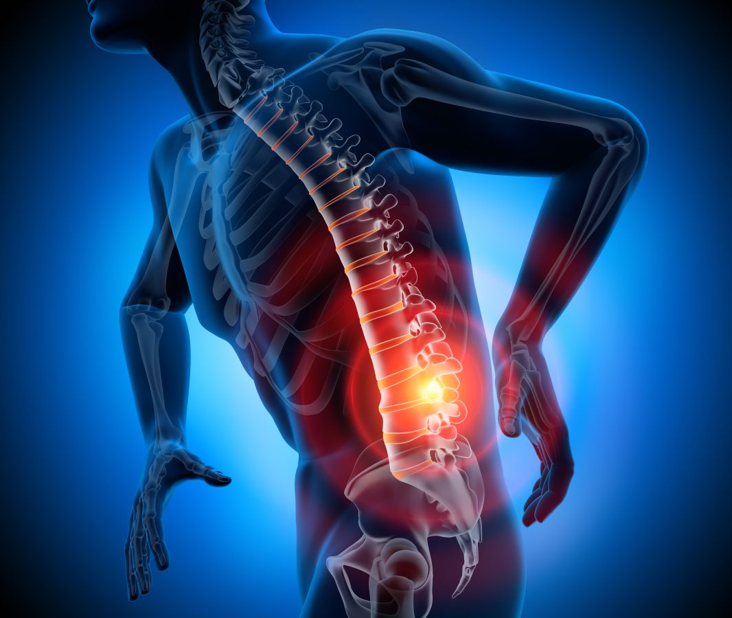 sciatic_pain